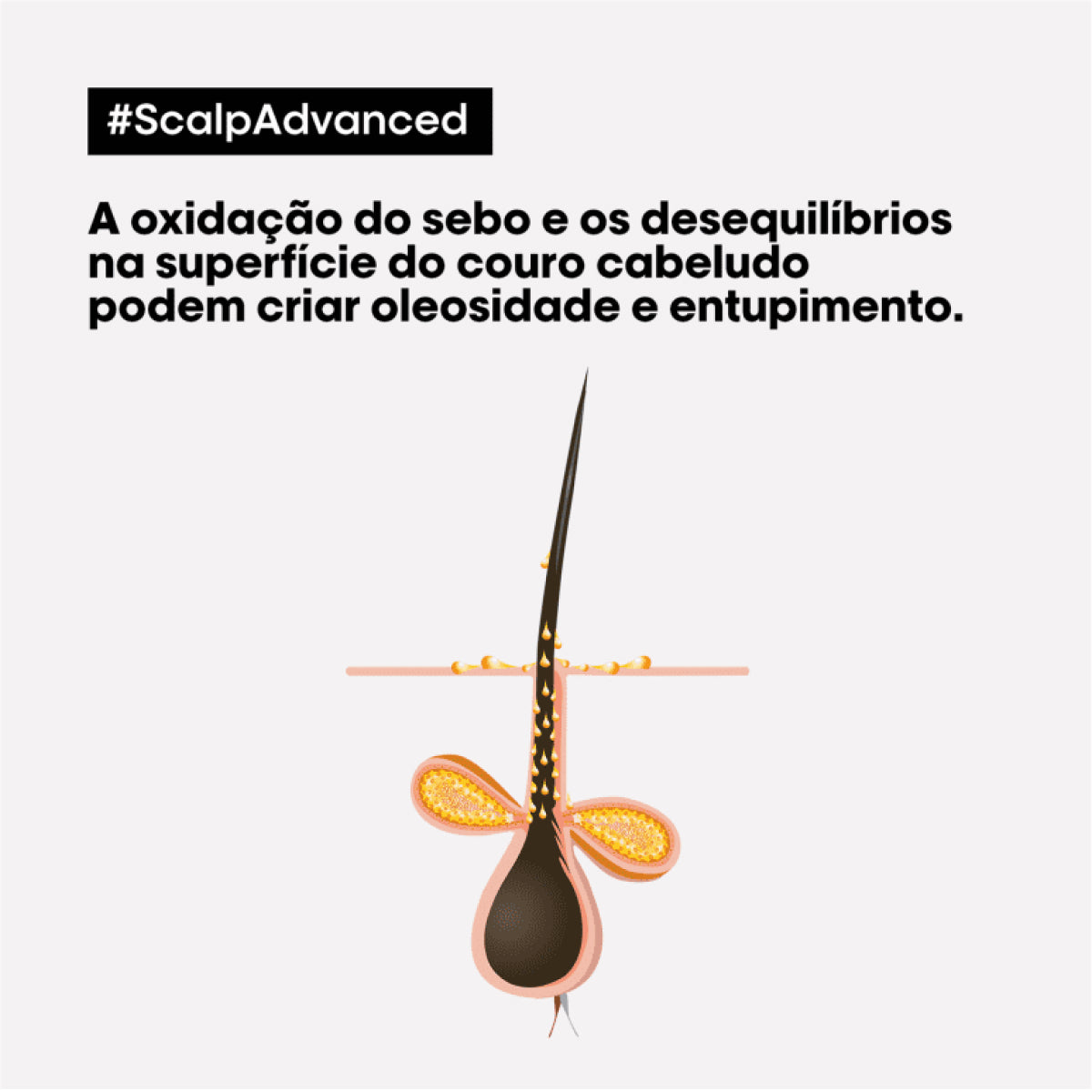 Máscara Loreal Scalp Advanced Anti Gras Oiliness 500 ml